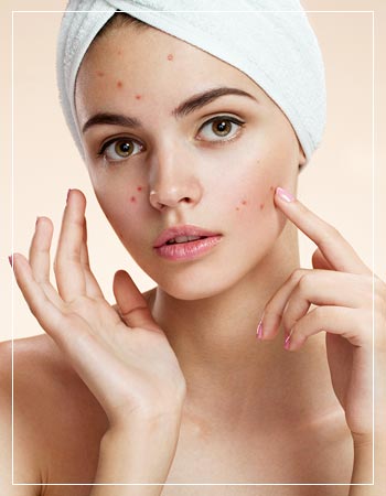 Acne Treatments Near Me in Frisco, TX