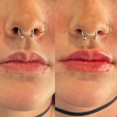 Before and After Photos of ABC Health and Beauty in Frisco, TX