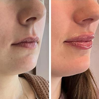 Before and After Photos of ABC Health and Beauty in Frisco, TX