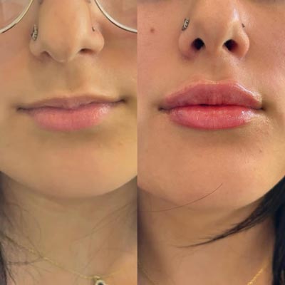 Before and After Photos of ABC Health and Beauty in Frisco, TX