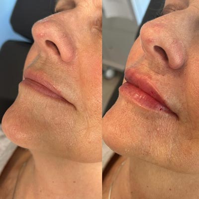 Before and After Photos of ABC Health and Beauty in Frisco, TX