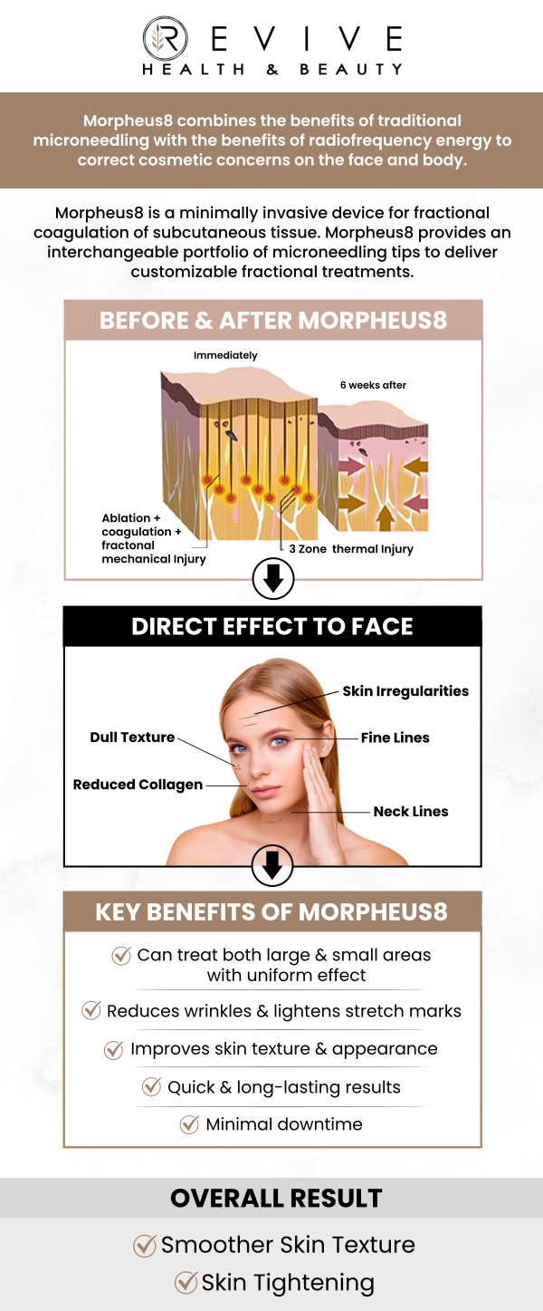Common questions asked by clients: What is Morpheus8 Treatment? What areas can Morpheus8 treat? What’s the downtime after Morpheus8? Can Morpheus8 be combined with other treatments? For more information, contact us or schedule an appointment online. We are conveniently located at 123 ABC Ave Suite A, Frisco, CA 123456.
