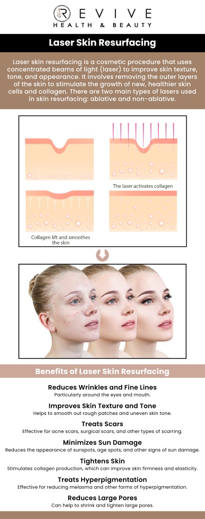 Common questions asked by clients: What is laser skin resurfacing? How does laser skin resurfacing improve skin? What skin concerns does laser resurfacing treat? How long does a laser resurfacing session take? For more information, contact us or schedule an appointment online. We are conveniently located at 123 ABC Ave Suite A, Frisco, CA 123456.
