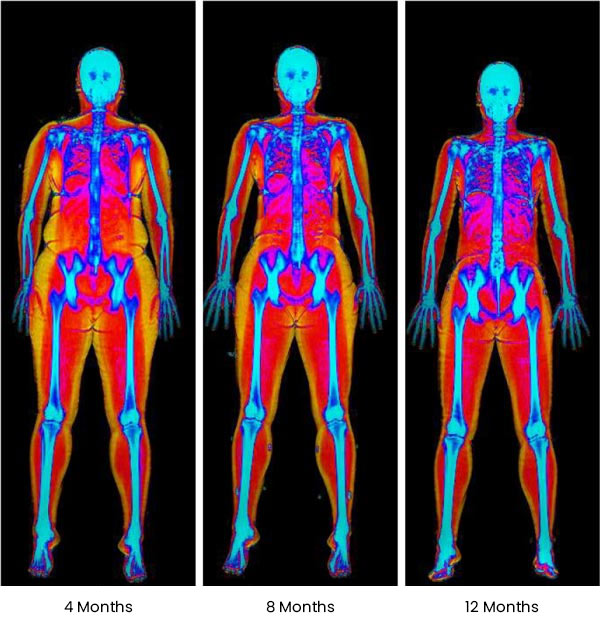 At ABC Health & Beauty, we specialize in medical weight loss programs tailored to your unique needs. Located in Frisco, TX, our experienced team works with you to design a personalized weight loss plan that addresses your goals and lifestyle. From nutritional guidance to personalized support, our comprehensive approach ensures you receive the care you need to succeed. Contact us today or book an appointment online. We are conveniently located at 123 ABC Ave Suite A, Los Altos, CA 123456.