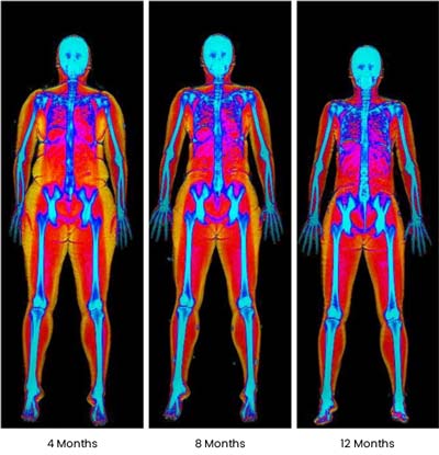 At ABC Health & Beauty, we specialize in medical weight loss programs tailored to your unique needs. Located in Frisco, TX, our experienced team works with you to design a personalized weight loss plan that addresses your goals and lifestyle. From nutritional guidance to personalized support, our comprehensive approach ensures you receive the care you need to succeed. Contact us today or book an appointment online. We are conveniently located at 123 ABC Ave Suite A, Los Altos, CA 123456.